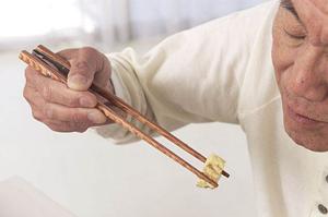 負担の少ないインプラント治療を名古屋で