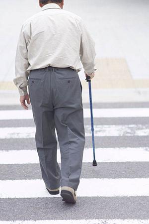 永久歯が抜けた後はインプラントを