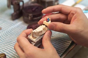 仙台で人気のマウスピース矯正を受ける